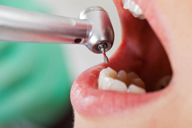 Best Emergency Treatment for Dental Infections or Abscesses in Baytown, TX